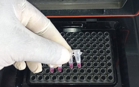 genomic DNA