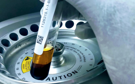Plasma sample for sequencing